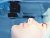Preguntas frecuentes sobre la operación de miopía