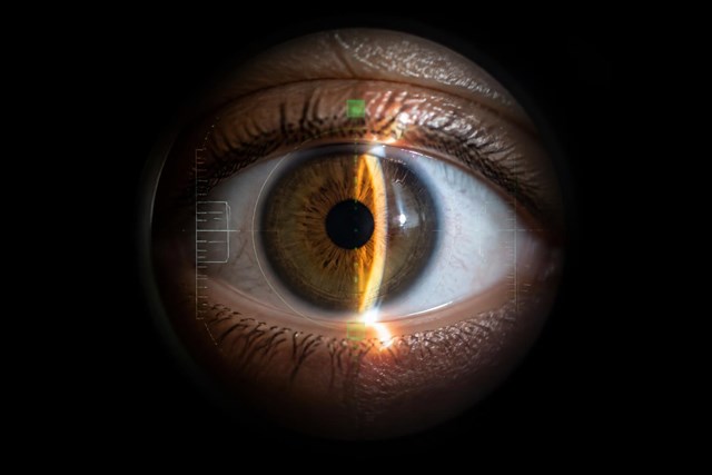 Tratamiento integral para el ojo seco en Pontevedra - Imagen 1